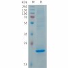 sp-PME101285 FGF19 Fig.1 SDS PAGE 1