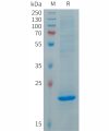 sp-PME101285 FGF19 Fig.1 SDS PAGE 1