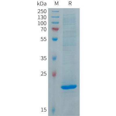 sp-PME101285 FGF19 Fig.1 SDS PAGE 1