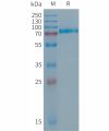 sp-PME101286 DSG2 Fig.1 SDS PAGE 1