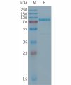 sp-PME101287 DSG2 Fig.1 SDS PAGE 1