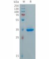 sp-PME101288 CXCL5 Fig.1 SDS PAGE 1