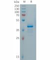 sp-PME101289 CALCA Fig.1 SDS PAGE 1