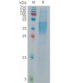 sp-PME101290 FCGR3B Fig.1 SDS PAGE 1