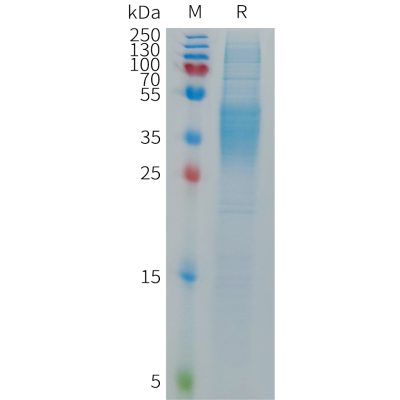 sp-PME101290 FCGR3B Fig.1 SDS PAGE 1