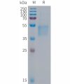 sp-PME101291 FSTL1 Fig.1 SDS PAGE 1