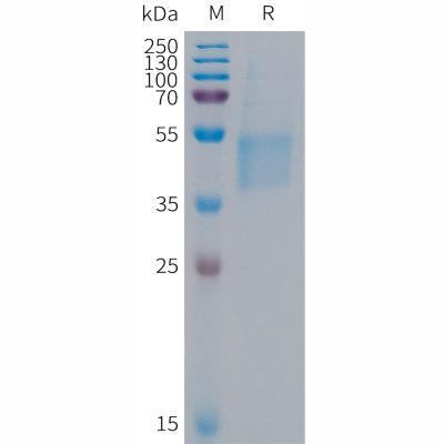 sp-PME101291 FSTL1 Fig.1 SDS PAGE 1