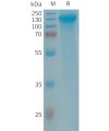 sp-PME101292 GPR64 Fig.1 SDS PAGE 1