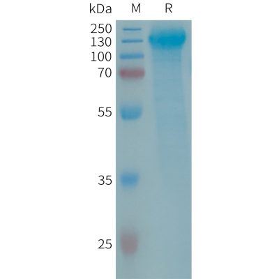 sp-PME101292 GPR64 Fig.1 SDS PAGE 1