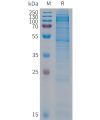 sp-PME101293 CDH19 Fig.1 SDS PAGE 1