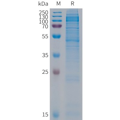 sp-PME101293 CDH19 Fig.1 SDS PAGE 1