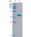 sp-PME101294 S100A9 Fig.1 SDS PAGE 1