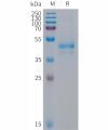 sp-PME101295 ARTN Fig.1 SDS PAGE 1