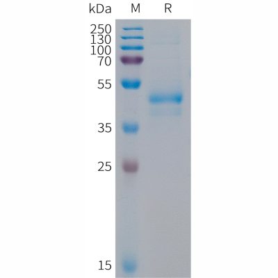 sp-PME101295 ARTN Fig.1 SDS PAGE 1