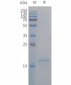 sp-PME101296 IL4 Fig.1 SDS PAGE 1