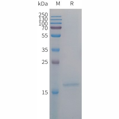 sp-PME101296 IL4 Fig.1 SDS PAGE 1