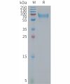 sp-PME101297 IBSP Fig.1 SDS PAGE 1