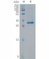 sp-PME101299 p16 Fig.1 SDS PAGE 1