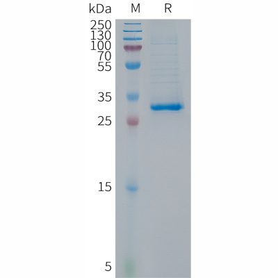 sp-PME101299 p16 Fig.1 SDS PAGE 1