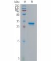 sp-PME101300 p16 Fig.1 SDS PAGE 1