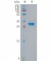 sp-PME101301 p16 Fig.1 SDS PAGE 1