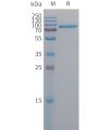 sp-PME101303 MELTF Fig.1 SDS PAGE 1