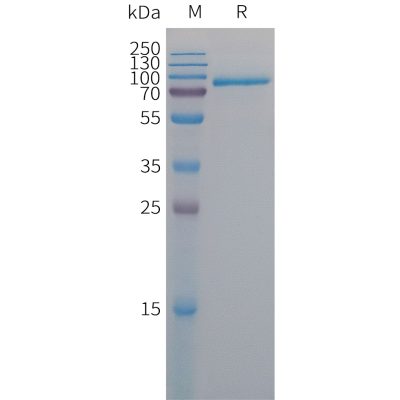 sp-PME101303 MELTF Fig.1 SDS PAGE 1