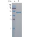 sp-PME101304 PAI1 Fig.1 SDS PAGE 1