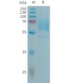 sp-PME101306 CD98 Fig.1 SDS PAGE 1