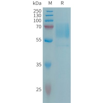 sp-PME101306 CD98 Fig.1 SDS PAGE 1