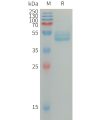 sp-PME101307 IL4 Fig.1 SDS PAGE 1