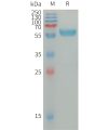 sp-PME101308 IGSF11 Fig.1 SDS PAGE 1