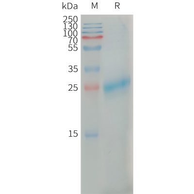 sp-PME101310 CLEC4C Fig.1 SDS PAGE 1