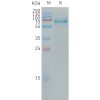 sp-PME101311 LILRB4 Fig.1 SDS PAGE 1