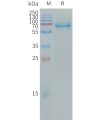 sp-PME101311 LILRB4 Fig.1 SDS PAGE 1