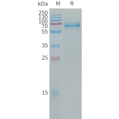 sp-PME101311 LILRB4 Fig.1 SDS PAGE 1