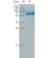 sp-PME101312 LOX 1 Fig.1 SDS PAGE 1