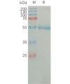 sp-PME101314 CFD Fig.1 SDS PAGE 1