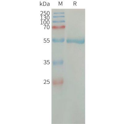 sp-PME101314 CFD Fig.1 SDS PAGE 1