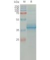 sp-PME101315 CCL11 Fig.1 SDS PAGE 1