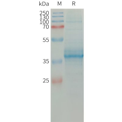 sp-PME101315 CCL11 Fig.1 SDS PAGE 1