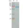 sp-PME101316 PLAT Fig.1 SDS PAGE 1