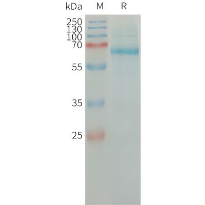 sp-PME101316 PLAT Fig.1 SDS PAGE 1