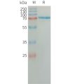 sp-PME101317 SEMA7A Fig.1 SDS PAGE 1