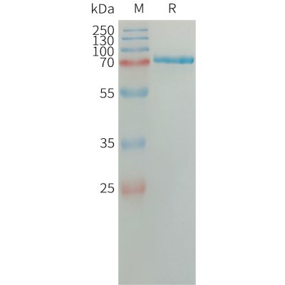 sp-PME101317 SEMA7A Fig.1 SDS PAGE 1