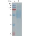 sp-PME101318 IL1RL2 Fig.1 SDS PAGE 1