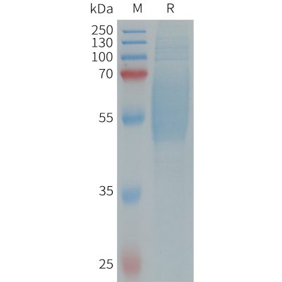 sp-PME101318 IL1RL2 Fig.1 SDS PAGE 1