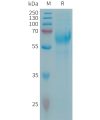 sp-PME101319 CSPG5 Fig.1 SDS PAGE 1