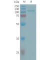 sp-PME101320 ENPP2 Fig.1 SDS PAGE 1