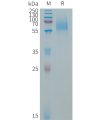 sp-PME101321 EGFRVIII Fig.1 SDS PAGE 1